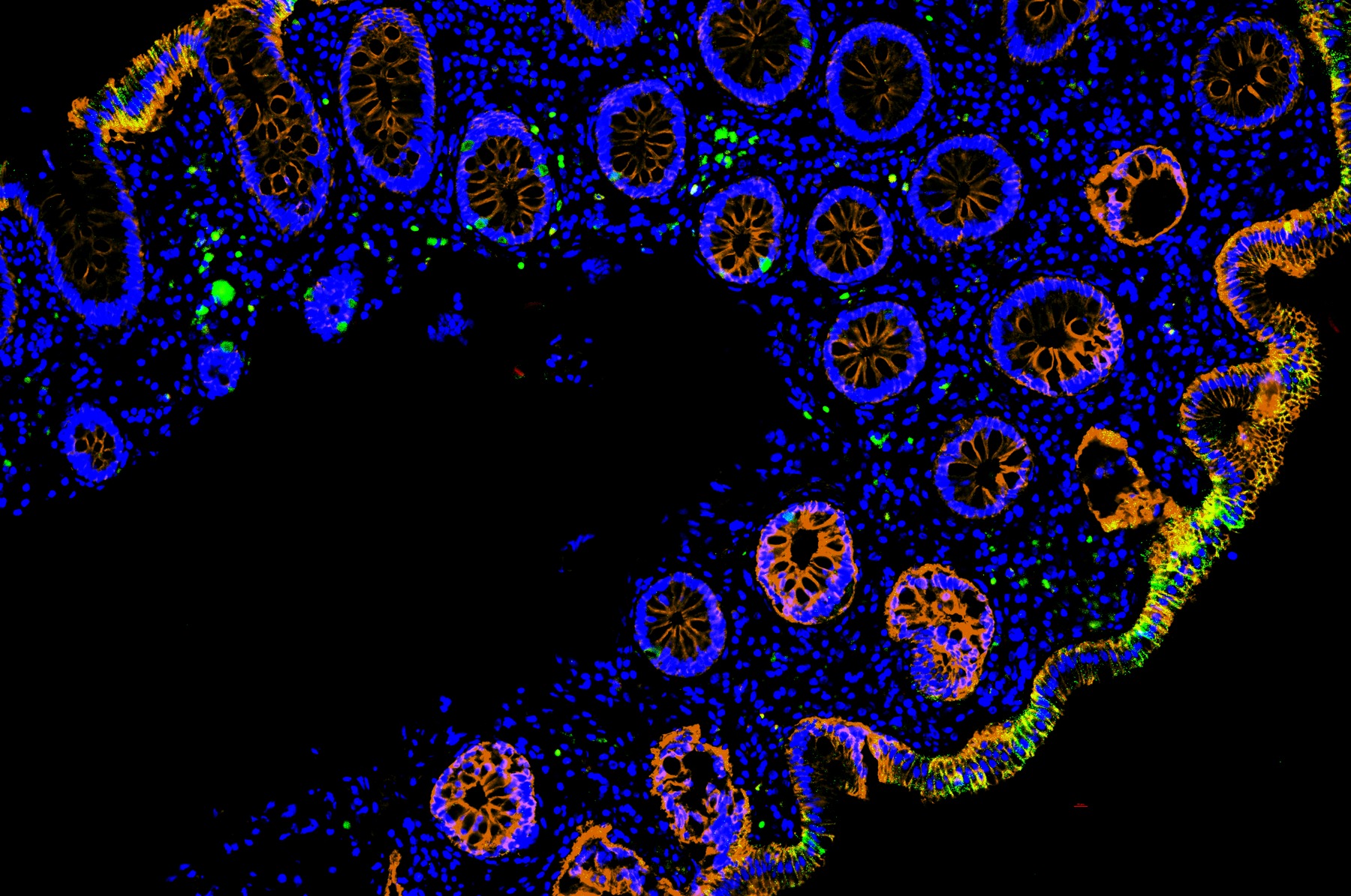 Multichannel fluorescence microscopy image of intestinal tissue associated with the viral persistence project